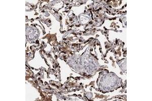 Immunohistochemical staining of human lung with SLC34A2 polyclonal antibody  shows strong cytoplasmic positivity in alveolar cells at 1:200-1:500 dilution. (SLC34A2 anticorps)