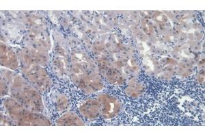 Detection of HGF in Human Stomach Tissue using Monoclonal Antibody to Hepatocyte Growth Factor (HGF)