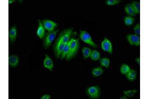 Immunofluorescence staining of A549 cells with ABIN7144503 at 1:66, counter-stained with DAPI. (Aquaporin 1 anticorps  (AA 209-301))