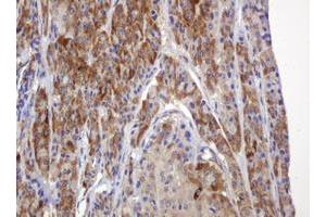 Image no. 3 for anti-TBC1 Domain Family, Member 13 (TBC1D13) antibody (ABIN1501310)
