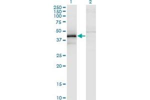 Western Blot analysis of ZFYVE19 expression in transfected 293T cell line by ZFYVE19 monoclonal antibody (M02), clone 3G4-2B11. (ZFYVE19 anticorps  (AA 1-396))
