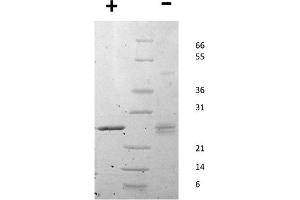 SDS-PAGE of Human Mouse Epstein-Barr Virus Induced Gene 3 Recombinant Protein SDS-PAGE of Mouse Epstein-Barr Virus Induced Gene 3 Recombinant Protein. (EBI3 Protéine)