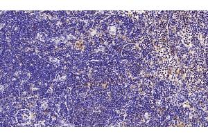 Detection of SIRT3 in Rat Lymph node Tissue using Polyclonal Antibody to Sirtuin 3 (SIRT3)