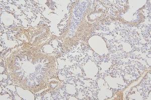 IHC analysis of TMEM255B using anti-TMEM255B antibody (ABIN7600444). (TMEM255B anticorps  (AA 196-240))