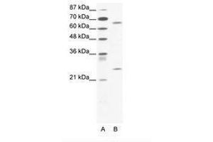 Image no. 1 for anti-Forkhead Box K2 (FOXK2) (C-Term) antibody (ABIN202858)