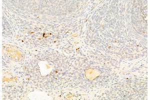 ABIN6265242 and ABIN6269269 at 1/100 staining Rat ovary tissue by IHC-P. (SOX9 anticorps)
