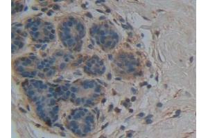 IHC-P analysis of Human Mammary gland Tissue, with DAB staining. (Apolipoprotein M anticorps  (AA 8-188))