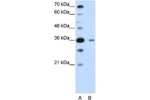 WB Suggested Anti-DAZAP1  Antibody Titration: 0. (DAZAP1 anticorps  (C-Term))