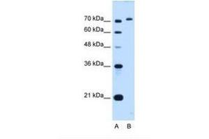 Image no. 1 for anti-GPI Anchor Attachment Protein 1 (GPAA1) (C-Term) antibody (ABIN6738244) (GPAA1 anticorps  (C-Term))
