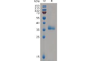 Human IG Protein, His Tag on SDS-PAGE under reducing condition.