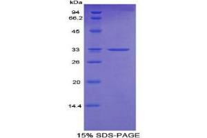 SDS-PAGE analysis of Mouse Cytochrome P450 24A1 Protein.
