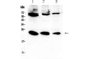 Western blot analysis of IL-2 using anti-IL-2 antibody . (IL-2 anticorps  (AA 21-153))