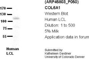 Image no. 2 for anti-Collagen, Type VI, alpha 1 (COL6A1) (Middle Region) antibody (ABIN2782366)