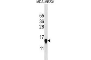 Western Blotting (WB) image for anti-Histone Cluster 2, H2aa3 (HIST2H2AA3) antibody (ABIN2997480) (HIST2H2AA3 anticorps)