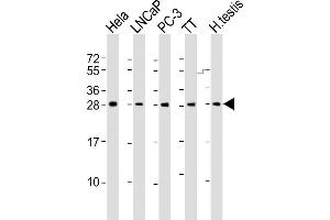 All lanes : Anti-SSX1 Antibody (Center) at 1:2000 dilution Lane 1: Hela whole cell lysate Lane 2: LNCaP whole cell lysate Lane 3: PC-3 whole cell lysate Lane 4: TT whole cell lysate Lane 5: human testis lysate Lysates/proteins at 20 μg per lane. (SSX1 anticorps  (AA 97-128))