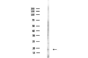 Western blot analysis of lysates from HepG2 cells(LPS,4h treatment), using IL1RN Antibody at 1/1000 dilution.