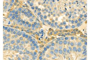 ABIN6262019 and ABIN6279471 at 1/100 staining Mouse testis tissue by IHC-P.