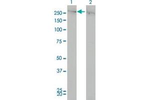 Western Blot analysis of CHD4 expression in transfected 293T cell line by CHD4 monoclonal antibody (M01), clone 4H4.