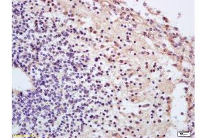 Formalin-fixed and paraffin embedded mouse embryo labeled with Anti-Phospho-cdc25A (Thr506) Polyclonal Antibody, Unconjugated (ABIN684028) at 1:200 followed by conjugation to the secondary antibody and DAB staining