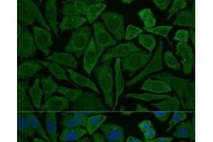 Immunofluorescence analysis of L929 cells using NDUFB2 Polyclonal Antibody at dilution of 1:100 (40x lens). (NDUFB2 anticorps)