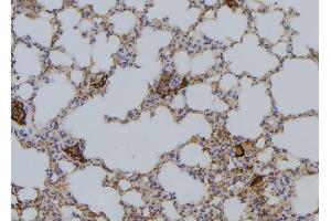 ABIN6276427 at 1/100 staining Mouse lung tissue by IHC-P.