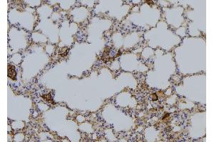 ABIN6276427 at 1/100 staining Mouse lung tissue by IHC-P.