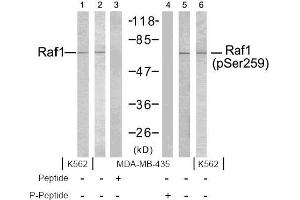 Image no. 2 for anti-V-Raf-1 Murine Leukemia Viral Oncogene Homolog 1 (RAF1) (pSer259) antibody (ABIN196618) (RAF1 anticorps  (pSer259))