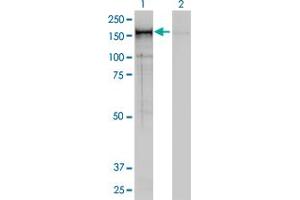Western Blot analysis of CNAP1 expression in transfected 293T cell line by CNAP1 monoclonal antibody (M01), clone 4C12.