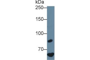 Detection of F8 in Human Hela cell lysate using Polyclonal Antibody to Coagulation Factor VIII (F8) (Factor VIII anticorps  (AA 1854-1988))