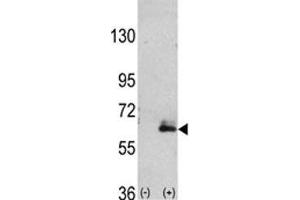 Western blot analysis of anti-MAP2 antibody and 293 cell lysate (2 ug/lane) either nontransfected (Lane 1) or transiently transfected with the hMAP2-Q425 gene (2). (MAP2 anticorps  (AA 1766-1796))