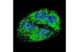 anti-BCL2/adenovirus E1B 19kDa Interacting Protein 3 (BNIP3) (AA 152-187) antibody