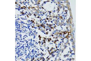 Immunohistochemistry of paraffin-embedded human tonsil using USO1 antibody (ABIN5971479) at dilution of 1/100 (40x lens). (USO1 anticorps)