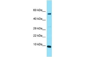 Host: Rabbit Target Name: C20orf166 Sample Type: Jurkat Whole Cell lysates Antibody Dilution: 1. (C20orf166 anticorps  (N-Term))