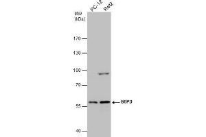 WB Image Various whole cell extracts (30 μg) were separated by 7.