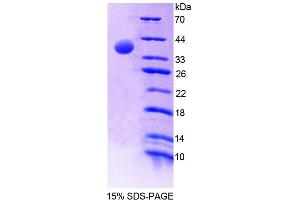 SDS-PAGE (SDS) image for Mitochondrial Methionyl-tRNA Formyltransferase (MTFMT) (AA 78-386) protein (His tag) (ABIN6237556)