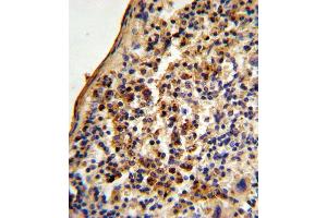 Formalin-fixed and paraffin-embedded mouse spleen tissue reacted with Ku70 Antibody (Center), which was peroxidase-conjugated to the secondary antibody, followed by DAB staining. (XRCC6 anticorps  (AA 432-461))