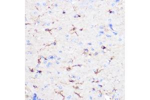 Immunohistochemistry of paraffin-embedded mouse brain using GFAP Rabbit pAb (ABIN3020750, ABIN3020751, ABIN3020752, ABIN1512943 and ABIN6213705) at dilution of 1:100 (40x lens).