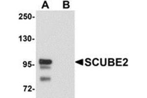 Western blot analysis of SCUBE2 in Daudi cell lysate with SCUBE2 antibody at 1 μg/ml in (A) the absence and (B) the presence of blocking peptide. (SCUBE2 anticorps  (Center))