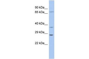 WB Suggested Anti-ASCL1 Antibody Titration: 0. (ASCL1 anticorps  (Middle Region))