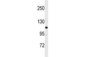MLCK antibody western blot analysis in SK-BR-3 lysate (MYLK anticorps  (AA 908-938))