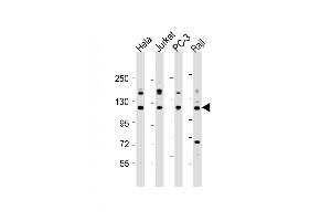 All lanes : Anti-REST Antibody (Center) at 1:2000 dilution Lane 1: Hela whole cell lysate Lane 2: Jurkat whole cell lysate Lane 3: PC-3 whole cell lysate Lane 4: Raji whole cell lysate Lysates/proteins at 20 μg per lane. (REST anticorps  (AA 542-570))