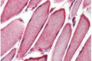 Human Skeletal Muscle (formalin-fixed, paraffin-embedded) stained with HSPB6 antibody ABIN364293 at 2.