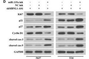 MBNL1-AS1 regulated the proliferation and apoptosis of BC cells via miR-135a/PHLPP2/FOXO1 axis. (Cyclin D1 anticorps  (AA 96-295))