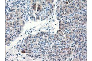 Immunohistochemical staining of paraffin-embedded Human pancreas tissue using anti-TBC1D21 mouse monoclonal antibody. (TBC1D21 anticorps)