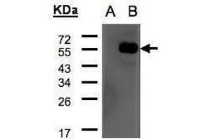 WB Image Western Blot analysis of ARHGAP1 expression in transfected 293T cell line by ARHGAP1 polyclonal antibody. (ARHGAP1 anticorps  (N-Term))
