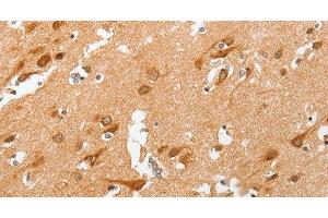 Immunohistochemistry of paraffin-embedded Human brain using cPLA2 Polyclonal Antibody at dilution of 1:50 (PLA2G4A anticorps)