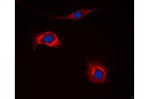 Immunofluorescent analysis of NPY2R staining in HeLa cells. (NPY2R anticorps  (N-Term))