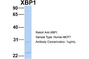 Host: Rabbit Target Name: NOP56 Sample Type: MCF7 Antibody Dilution: 1. (XBP1 anticorps  (C-Term))