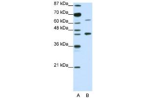 WB Suggested Anti-RARA Antibody Titration:  1. (Retinoic Acid Receptor alpha anticorps  (N-Term))