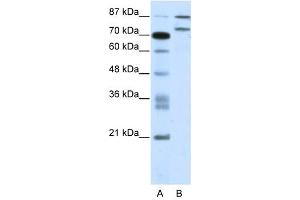 Western Blot showing ZNF709 antibody used at a concentration of 1-2 ug/ml to detect its target protein. (ZNF709 anticorps  (N-Term))